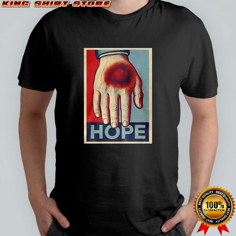 Donald Trump bruise hand Hope shirt